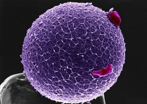 Cell子刊：北大团队揭示高糖抑制AMPK信号通路的分子机制