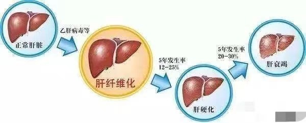 b843be04868fb95ddc4a2eea0e72839.jpg